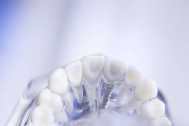 Fogorvos fogászati modell - Fotó, kép