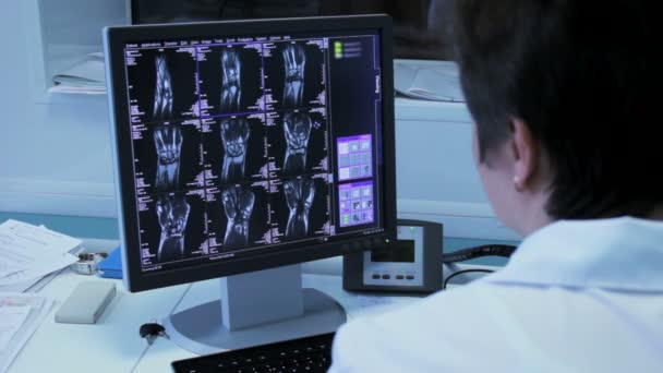Γυναίκα γιατρός σε ένα νοσοκομείο εξερευνητές του x-ray εικόνες για την οθόνη γκρο πλαν - Πλάνα, βίντεο