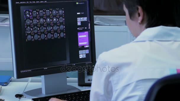 Az orvos megvizsgálja az agy képek a számítógép - Felvétel, videó