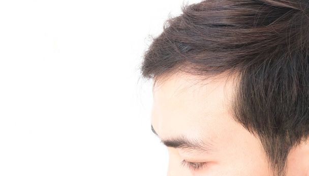 Молодой человек беспокоиться проблемы выпадения волос для здравоохранения шампунь и концепция косметического продукта
 - Фото, изображение