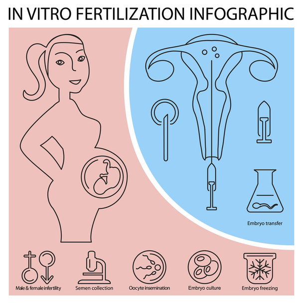 Az in vitro megtermékenyítés infographic - Vektor, kép
