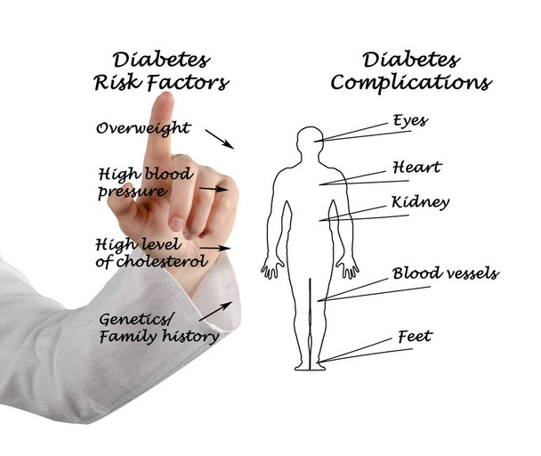 Παραγόντων κινδύνου του διαβήτη και των επιπλοκών - Φωτογραφία, εικόνα