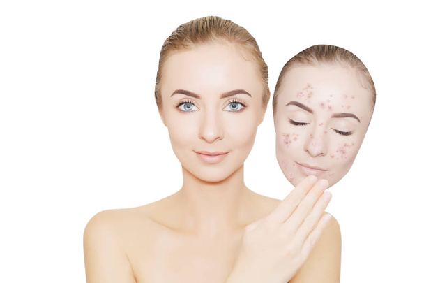 woman takes away mask with acne and pimples,white background - Valokuva, kuva