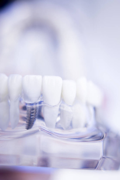 Dentisti modello dentale
 - Foto, immagini