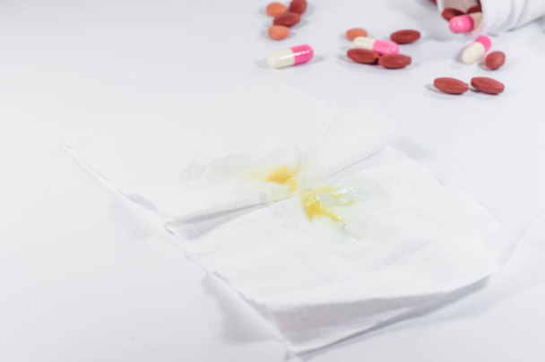 der gelbe und grüne Rotz auf weißem Seidenpapier mit Pille. erkältungskrank - Foto, Bild