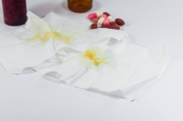 de gele en groene snot op witte papieren zakdoekje met pil. koude ziek - Foto, afbeelding