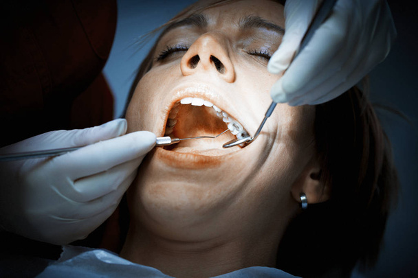 Zahnarzt untersucht Zähne eines Patienten vor einer oralen Operation an der de - Foto, Bild