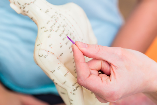 Heilpraktiker erklärt Akupunktur - Foto, Bild