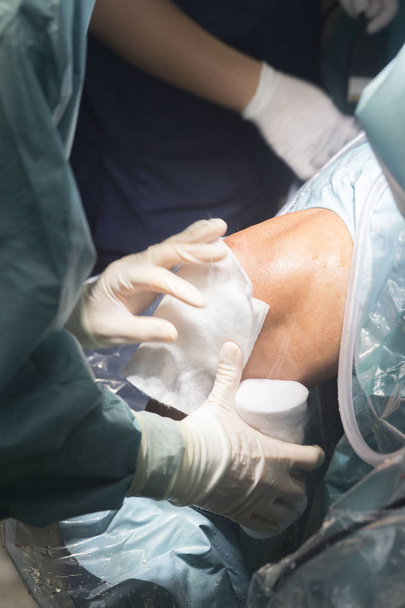 хірургія коліна медсестра перев'язування
 - Фото, зображення