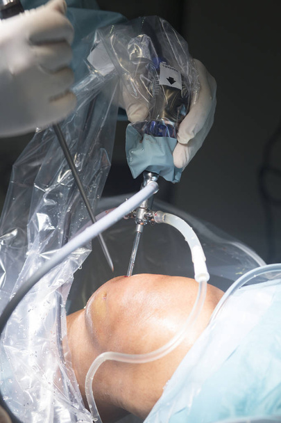 Knee surgery hospital operation - Valokuva, kuva