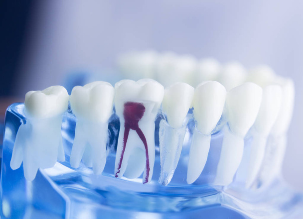 Dental tooth root model - Foto, imagen