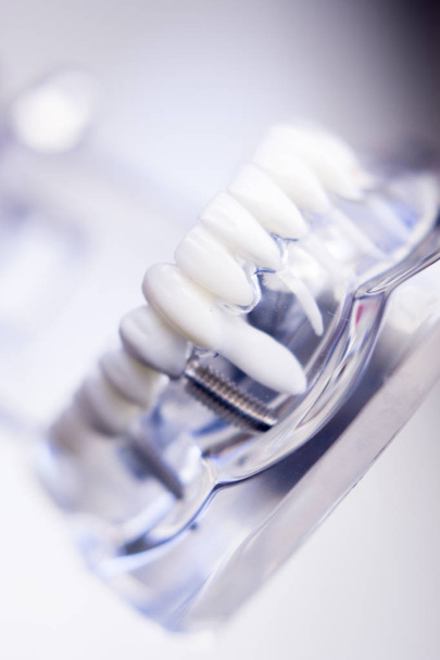 Hammaslääkärit hampaiden malli
 - Valokuva, kuva