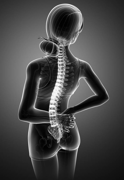 Mujeres sintiendo el dolor de espalda
  - Foto, Imagen
