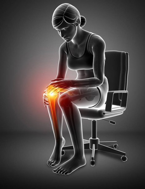 Vrouwen knie gewrichtspijn - Foto, afbeelding