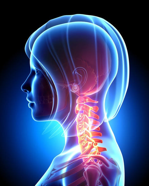 Женская боль в шее в синем
 - Фото, изображение