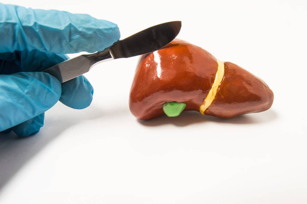 Surgeon's hand in blue latex glove holding scalpel over anatomical figure of human liver. Concept that symbolizes process of surgery treatment of liver diseases such as cancer, hydatid disease ets. - Photo, Image