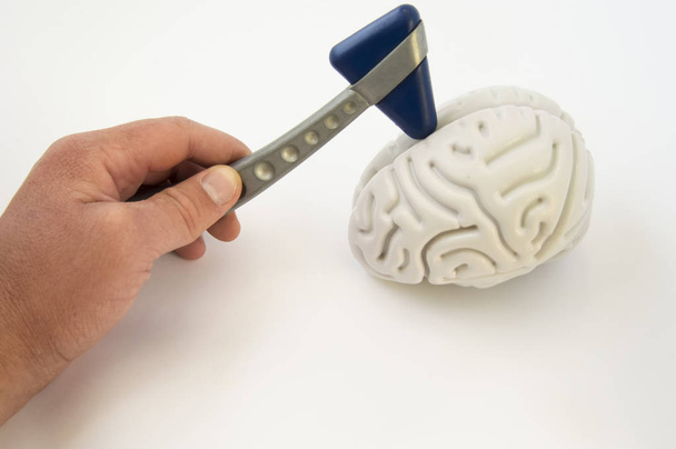 Νευρολόγο, κρατώντας μια νευρολογική σφυρί, διεξάγει εξετάσεις του εγκεφάλου. Η ιδέα για την εξέταση του ασθενούς ή μια ιατρική έρευνα προς την κατεύθυνση της Νευρολογίας και παθολογίας - Φωτογραφία, εικόνα