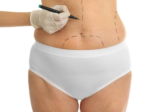Surgeon drawing marks on female body - Photo, image