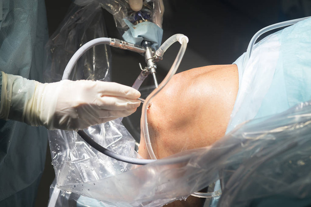 Cirugía de rodilla operación hospitalaria
 - Foto, Imagen