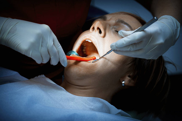 Behandeling een patiënten tanden voor de mondelinge ingreep bij de tandarts - Foto, afbeelding