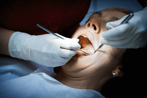 Zahnarzt untersucht Zähne eines Patienten vor einer oralen Operation an der de - Foto, Bild