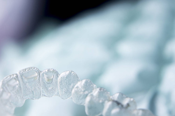 Frenos de plástico dentales invisibles
 - Foto, Imagen