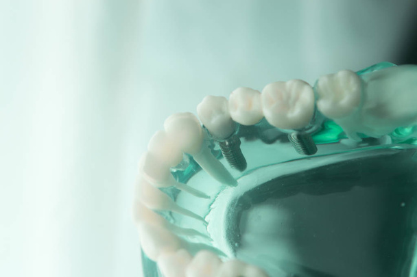 Modelo de odontología dental
 - Foto, imagen