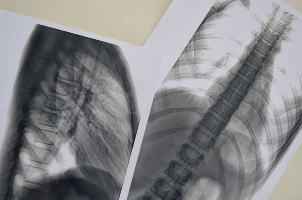 Imagen de la columna vertebral Rengen - examen de diagnóstico
 - Foto, imagen