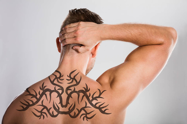 Laser Tattoo Removal - Фото, изображение
