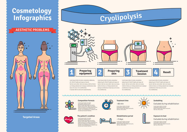 Vektor illustriertes Set mit kosmetologischer Kryolipolyse-Behandlung - Vektor, Bild