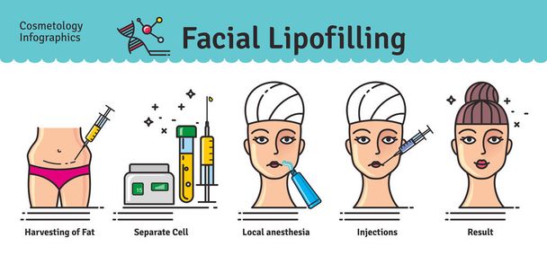 Vector Illustrated set with cosmetology facial lipofilling - Vector, Image