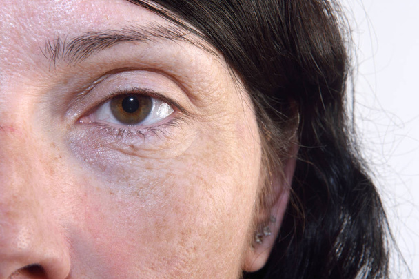 Rimpels in de ogen van een middelbare leeftijd vrouw 40-45 jaar - Foto, afbeelding