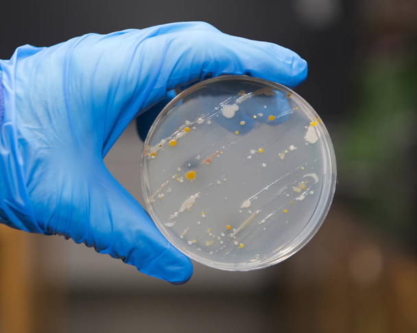 Bactérias em uma placa de ágar
 - Foto, Imagem