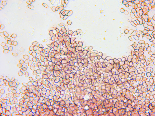 Мікроскопічний перегляд еритроцитів
 - Фото, зображення