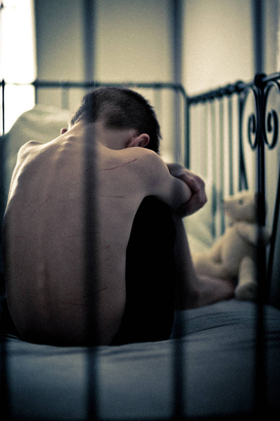 Jeune garçon maltraité avec des cicatrices corporelles assis sur le lit
 - Photo, image