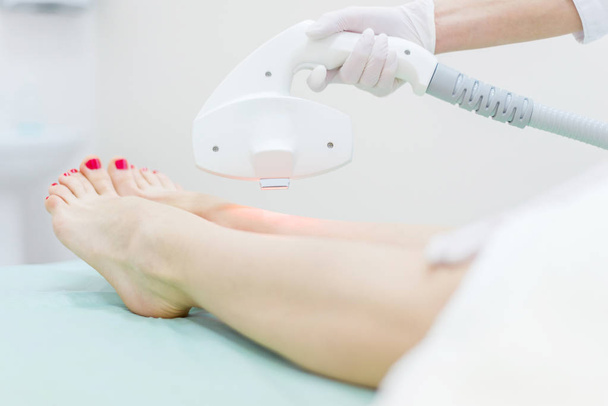 Laser hair removal on ladies legs - Foto, immagini
