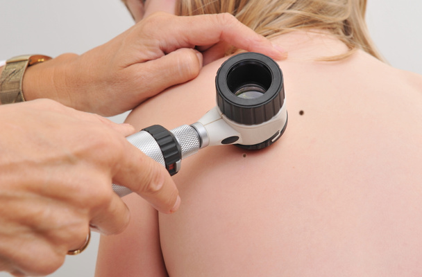 Dermatologista examina marca de nascença de paciente infantil
 - Foto, Imagem