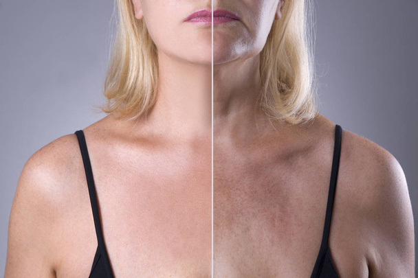 Rejuvenation woman's skin, before after anti aging concept, wrinkle treatment, facelift and plastic surgery - Fotó, kép