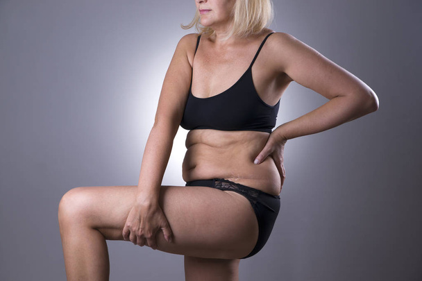 Woman in black lingerie, overweight female aging body, on gray background - Fotografie, Obrázek