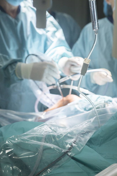 Knie operatie ziekenhuis operatie - Foto, afbeelding