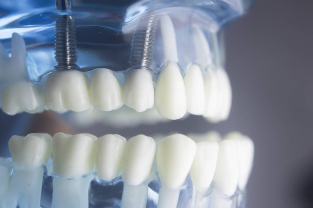 Model stomatologie zubní zuby - Fotografie, Obrázek