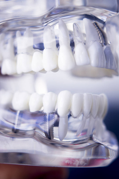 Dentists dental teeth model - Фото, зображення