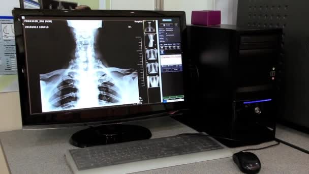 Röntgenbild - Filmmaterial, Video