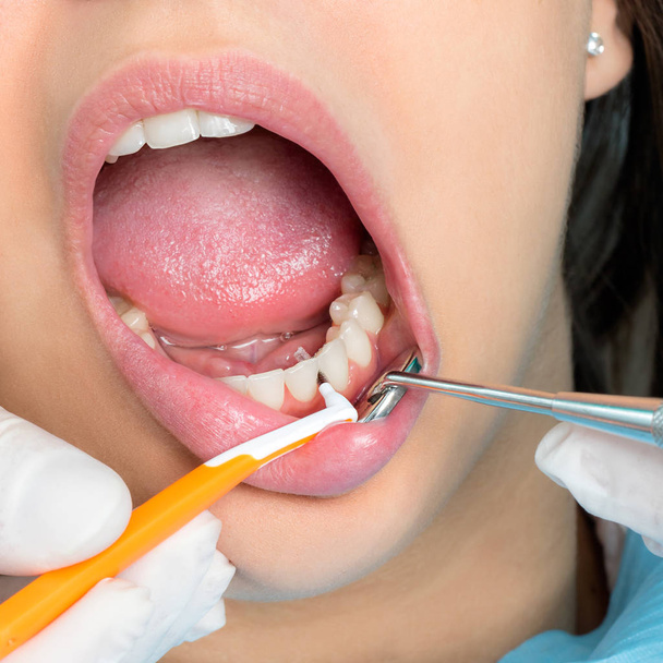 Interdental cleaning on human teeth - Photo, Image