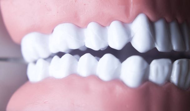 Tandheelkundige tanden tandheelkunde model - Foto, afbeelding