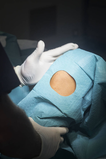 Knee surgery surgical operation - Fotografie, Obrázek