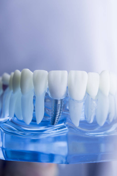 Οδοντιατρική δόντια μοντέλο οδοντιατρικής - Φωτογραφία, εικόνα
