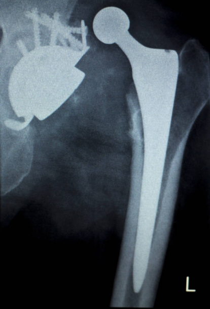 Рентгеновский скан
 - Фото, изображение