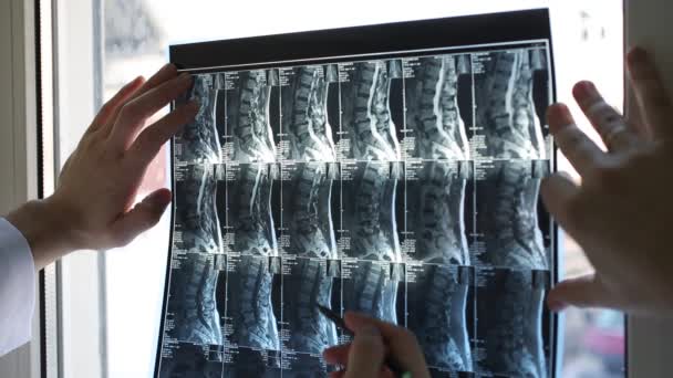 Lékař zkoumá rentgen - Záběry, video
