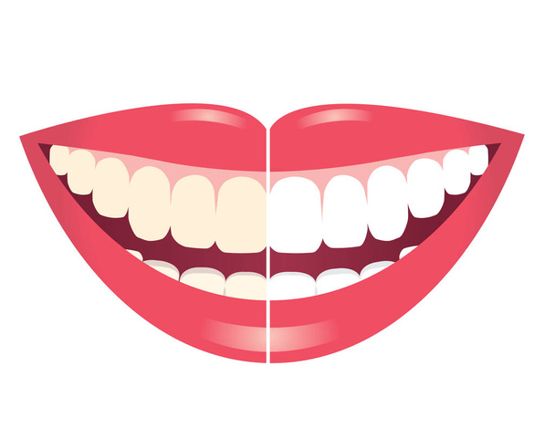 fogfehérítés fogak fehér háttér  - Vektor, kép
